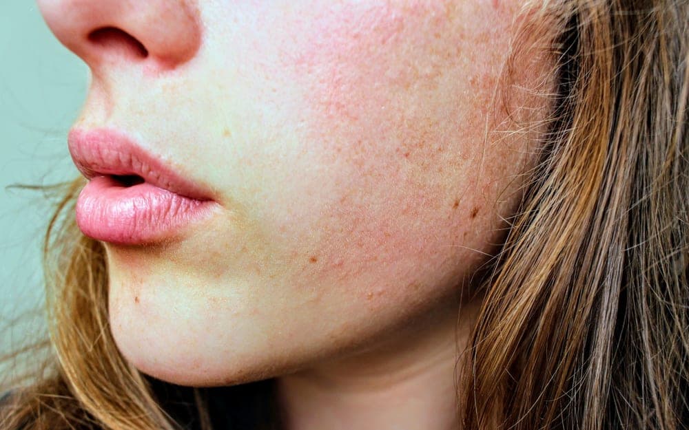 Calm, even-toned skin in soft light