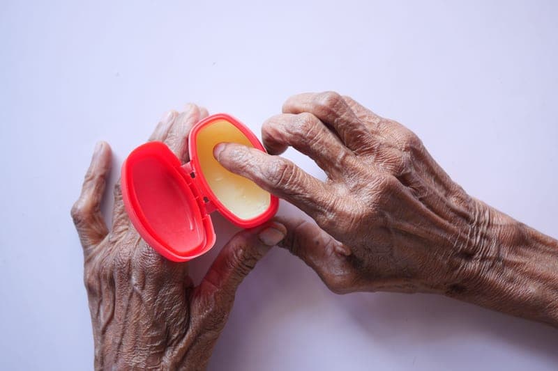 Moisturizer applied to dry skin on a hand